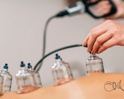 Hacamat Günleri: 2024 Hacamat Takvimi